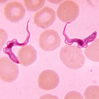 Trypanosoma from patient with African trypanosomiasis