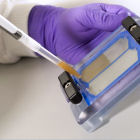 Tuberculosis DNA sequencing