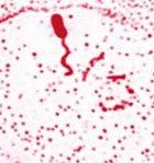 A Vibrio cholerae bacterium