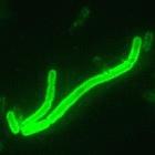 The bacterium<I>Yersinia pestis</i> (magnified) is the cause of plague