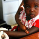 A young Ugandan girl has her blood tested for malaria