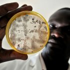 African scientist studying bean disease