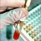 Testing blood for HIV in India