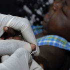 Baby receiving finger prick test