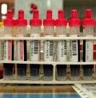 Blood tests were run on anonymous samples