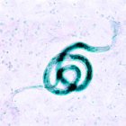 Brugia malayi, a cause of filariasis.