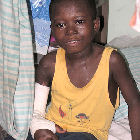 A boy with Buruli ulcer in Ghana
