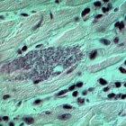 <i>Trypanosoma cruzi</i>