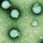 Chikungunya virus particles