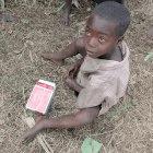 A malnourished child with biscuits used in refeeding programmes