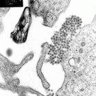 An electron microscope image of dengue fever