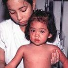 Dengue fever is a particular threat to children in areas such as South East Asia