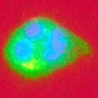 Dengue virus infected cell