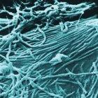 Repeated outbreaks of the Zaire strain of Ebola virus in central Africa were caused by the virus spreading, rather than by a dormant strain emerging at each site