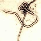 Ebola virus