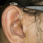Hearing aid Hearing aid