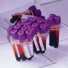 Scientists want more funds for HIV research
