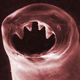 A hookworm