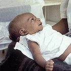 The new guidelines can help identify babies requiring hospital admission