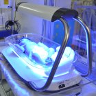 Baby being treated using Firefly device