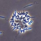 Leishmania donovani