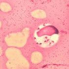 <em>Leishmania donovani</em> in a bone marrow cell