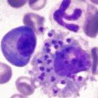 The Leishmaniasis parasite