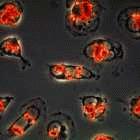 Leishmaniasis parasites
