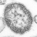 The measles virus of the <i>Paramyxovirinae</i> family
