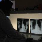 A nurse checks lung X-rays for TB in South Africa
