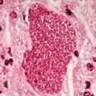 Differences between plasmodium strains are affecting vaccine research