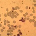 The <i>Plasmodium falciparum</i> parasite infecting red blood cells