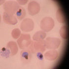 Plasmodium falciparum