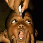 A child receiving the polio vaccine
