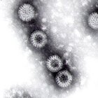 Black and white slide of the rotavirus