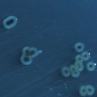 Salmonella Typhi colonies