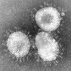SARS coronavirus