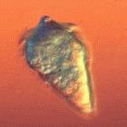 The parasite that cause schistosomiasis