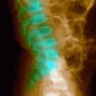 Huang claims to be able to treat spinal injuries, but Western scientists are sceptical