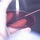TB samples in the lab