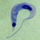 <I>Trypanosoma cruzi</i>, the parasite that causes Chagas disease