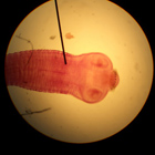  <i>Taenia solium</i>