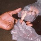 Testing patients for AIDS