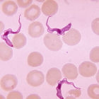 trypanosoma