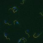 Trypanosome parasites