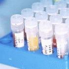Samples waiting to be tested for trypanosomiasis