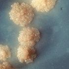 <i>Mycobacterium tuberculosis</i> colony